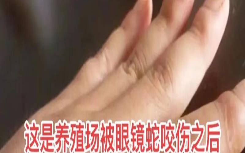 梦见被眼镜蛇咬了手（梦见被眼镜蛇咬了手指头）