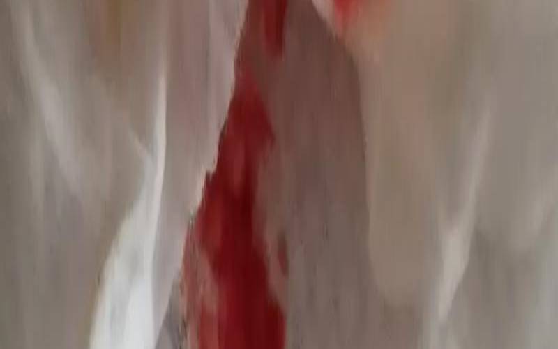 梦见爱人咳嗽吐血（梦见亲人咳嗽咳出血）