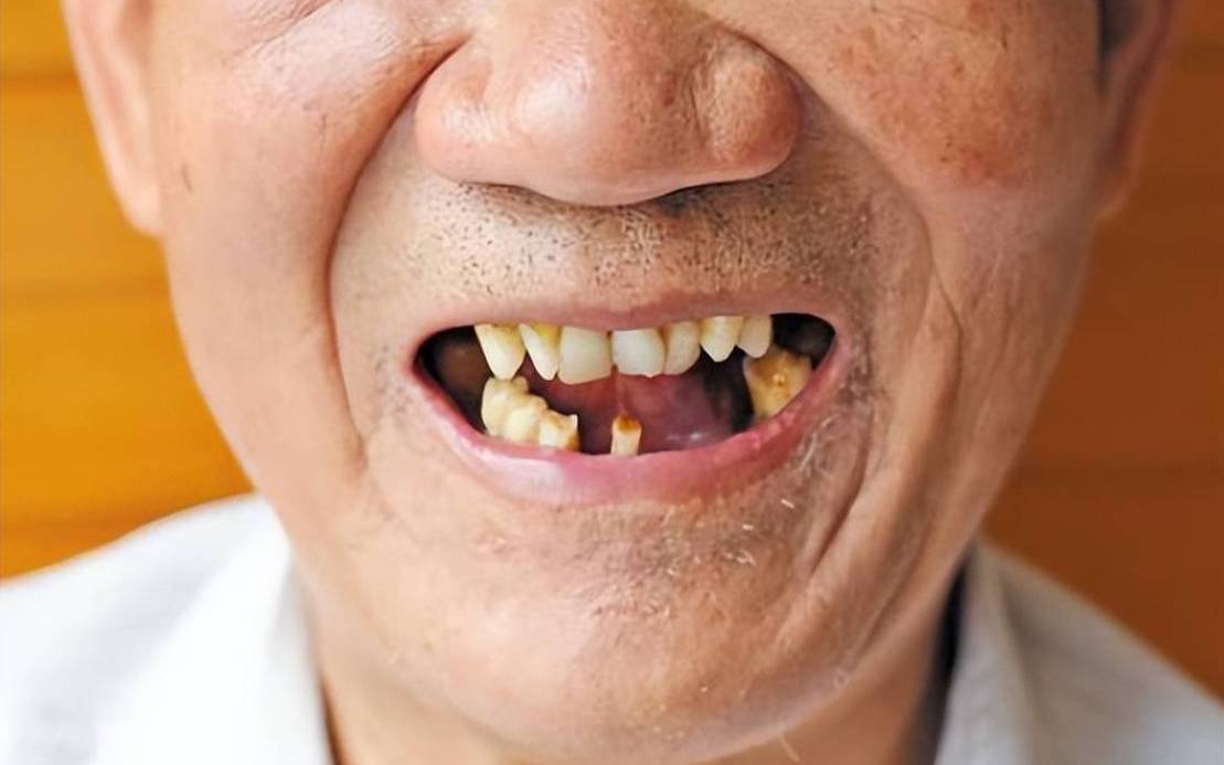 老是梦见掉牙大把的掉（梦见掉牙真会死人吗）