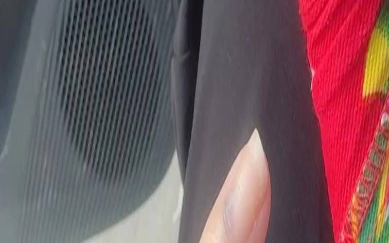 梦见被狗咬到手出血是什么兆头（梦见狗咬到手出血好不好）