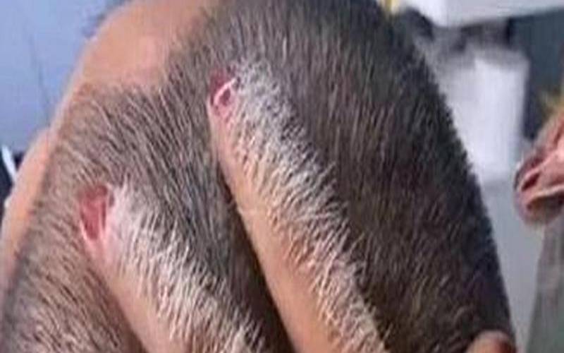 梦到自己有白头发了还拔了（女人梦见白发是吉兆吗）