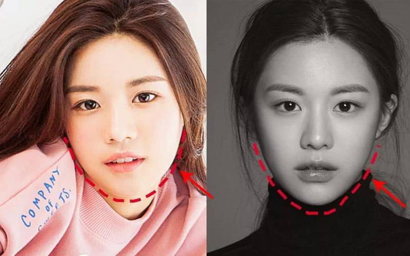 梦到自己整容（昨晚梦见自己整容）