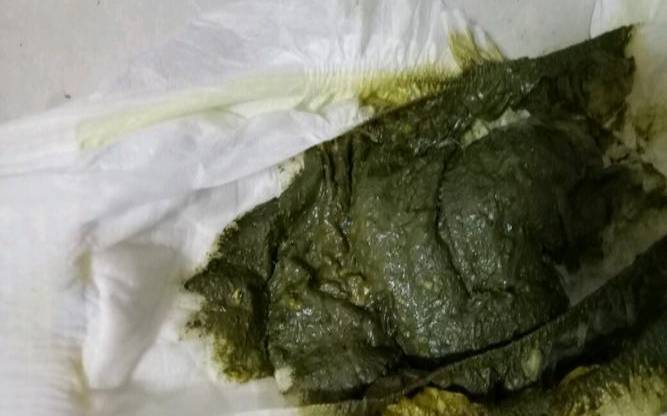 梦见屎象征着什么（梦见自己拉大便的吉凶）