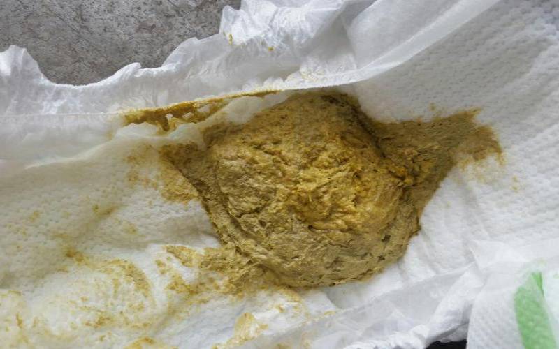 梦见宝宝拉大便是什么意思（梦见婴儿拉屎是要发财的）