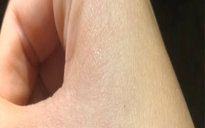 梦见被猫抓伤了手怎么办（梦见猫挠伤手是吉兆）