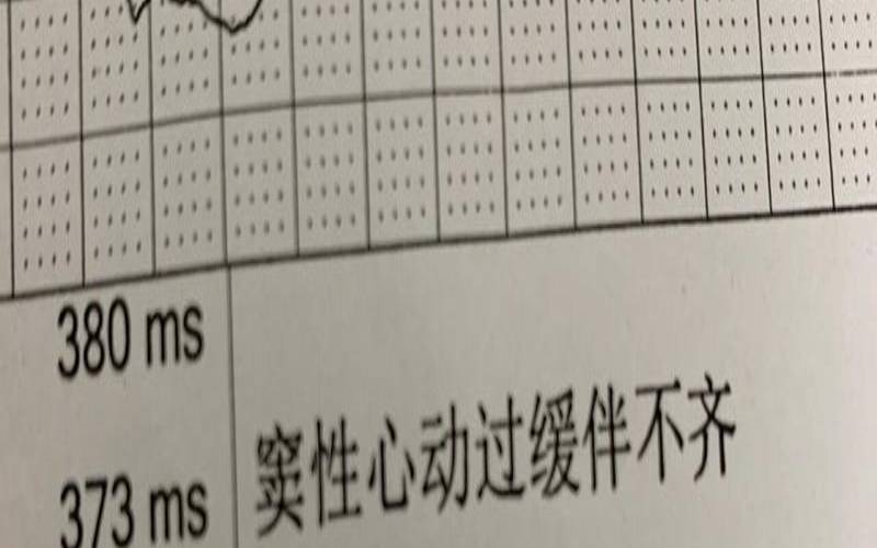 有了对象遇到心动的人（窦性心动缓慢伴不齐）