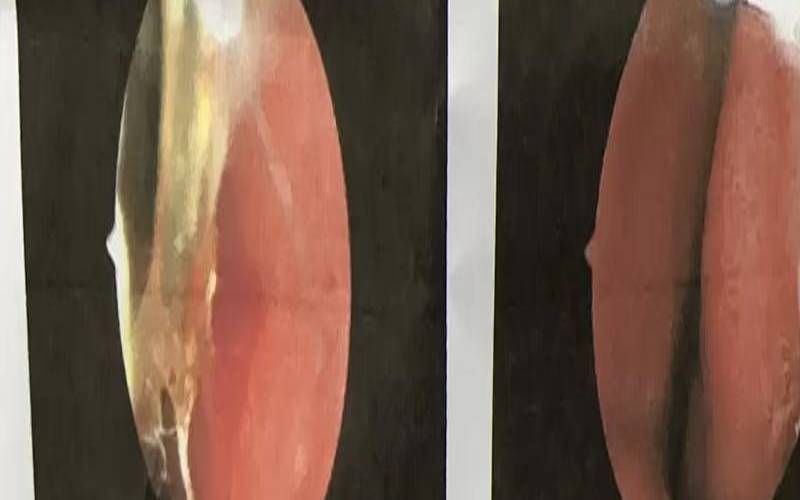 梦见鼻涕鼻屎什么意思（梦见掏出一大块鼻屎）