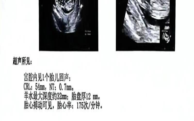 做梦自己怀孕了又是假孕（出现假怀孕是怎么回事）