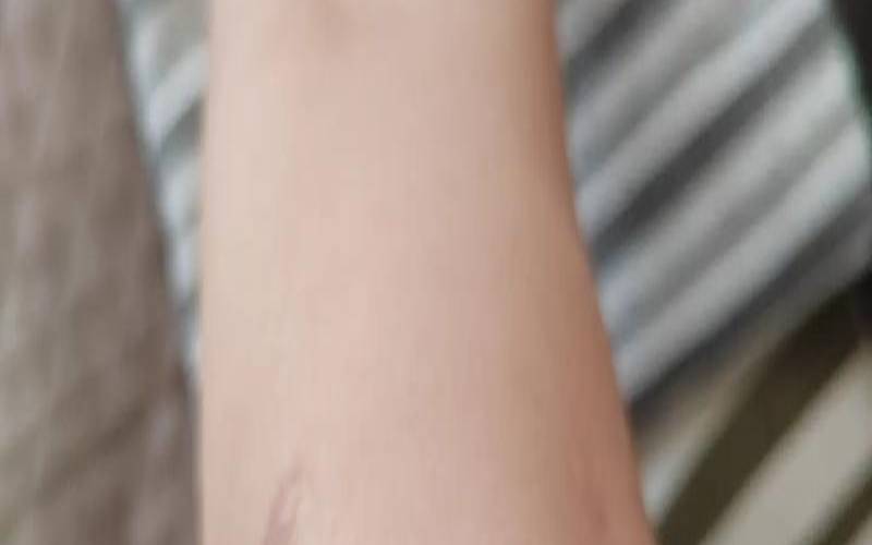 梦见手被割破流血了还疼（女人手出血的七大预兆）