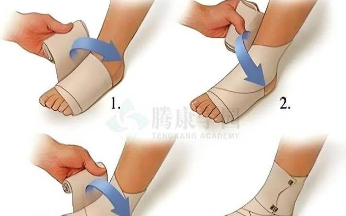 脚踝八字包扎视频（脚踝扭伤包扎图片）