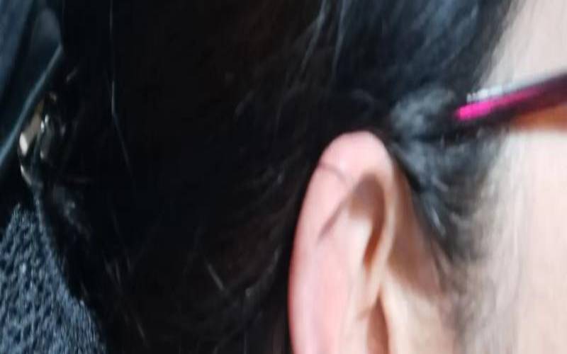 耳热预测吉凶91（女人右耳热吉凶）