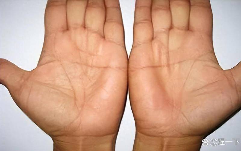 单断掌和双断掌（双手断掌能活到多少岁）