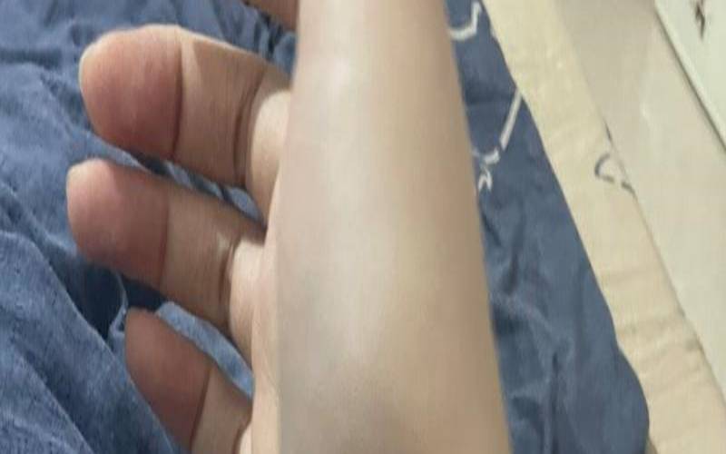 屁股肉跳预示着什么（各个部位肉跳的预兆）