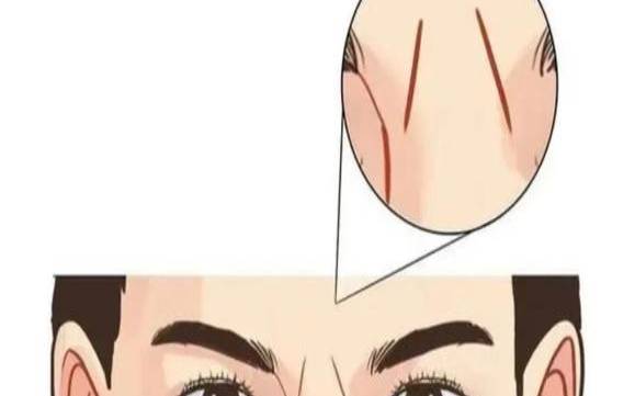 额头倒八字纹面相好不好呢（额头长八字纹怎么回事）