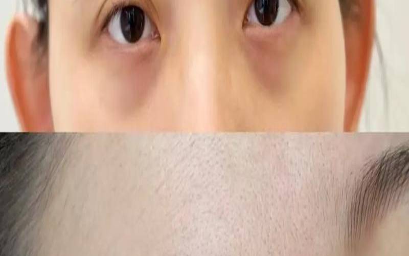 八字眉毛面相（八字眉修后对比照）