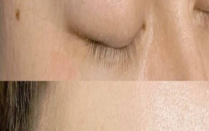 男人掉眉毛预示吉凶吗（男人掉眉毛怎么处理）