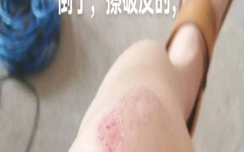 早上出门摔倒吉凶是什么（女人大清早摔倒什么预兆）