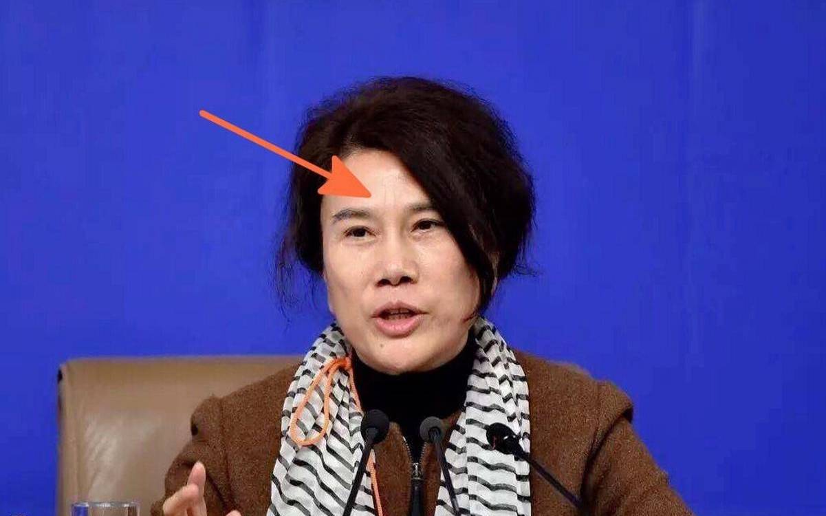 女人八字纹有痣好不好看（印堂八字纹的女人命好吗）