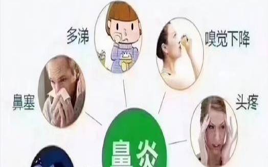 鼻子头痒痒有什么预兆（鼻子痒十二时辰吉凶）