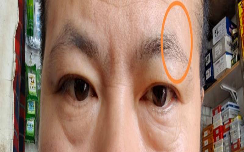 左边有根白眉毛好不好（左眉毛有一根白眉毛好不好）