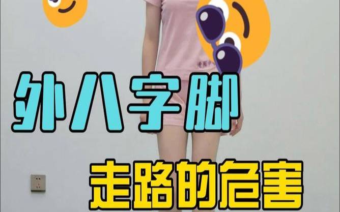 脚外八字怎么纠正过来（单脚外八字是什么原因）